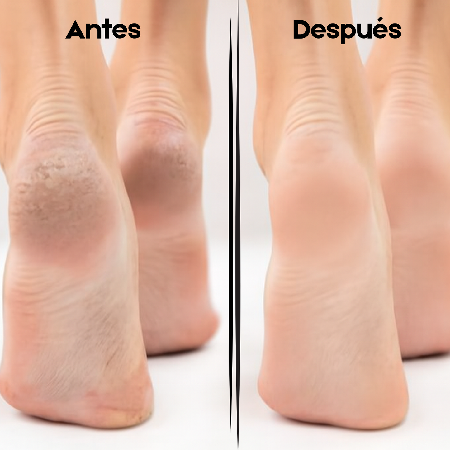 Lima Eléctrica para Cuidar tus Pies de Forma Sencilla